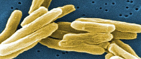 Возбудитель заболевания – микобактерия туберкулёза.
